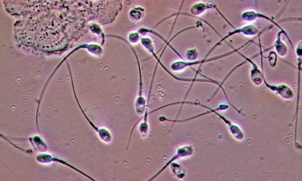 Studies show alarming sperm count falls, but some distrust the figures