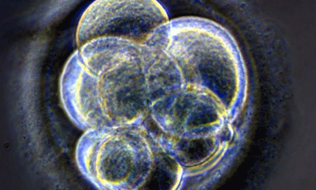 Britain's first cloned embryo created by Newcastle Uni team