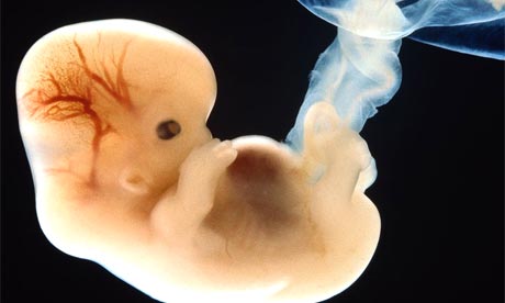 A six-week-old human embryo