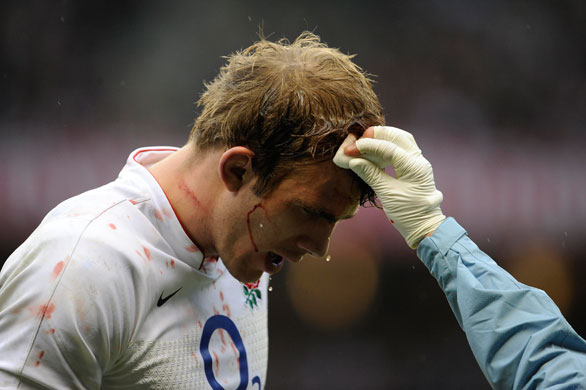 England v All Blacks: Tom Croft receives treatment for a head cut