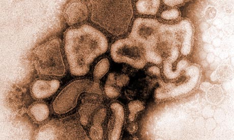Electron micrograph of  A H1N1 swine or porcine flu virus 