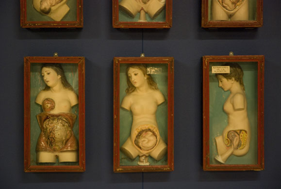 Exquisite Bodies: Exquisite Bodies at the Wellcome Collection