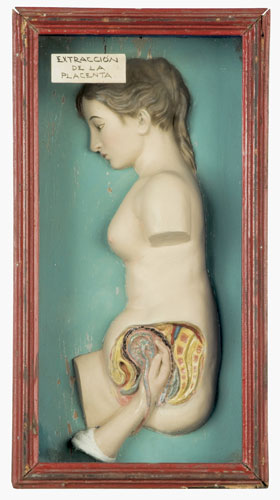 Exquisite Bodies: Exquisite Bodies at the Wellcome Collection