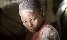 A child injured in an earthquake at a Hotel in Port-au-Prince, Haiti 
