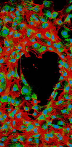  From the heart: Heart photo competition: Inflamed artery