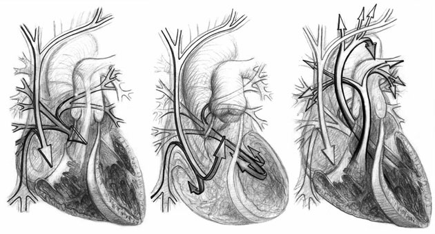  From the heart: Heart photo competition: Blood flow