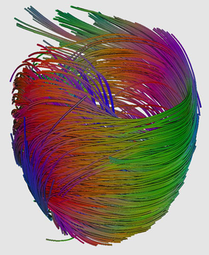  From the heart: Heart photo competition: Muscle fibres