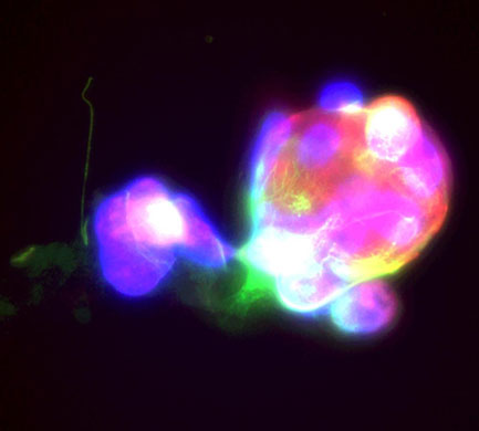  From the heart: Heart photo competition: Megakaryocytes