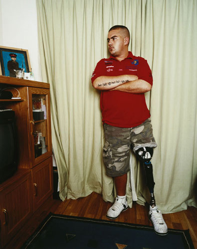 Isolation: A man stands next to his graduation photo, showing his artificial leg