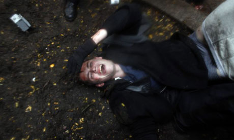 http://static.guim.co.uk/sys-images/Guardian/Pix/pictures/2011/11/17/1321558948693/Brandon-Watts-lies-injure-007.jpg