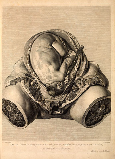 Babies & Books : exhibition at Cambridge University Library