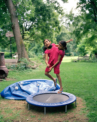 Conjoined twins: Conjoined twins: Carmen and Lupita