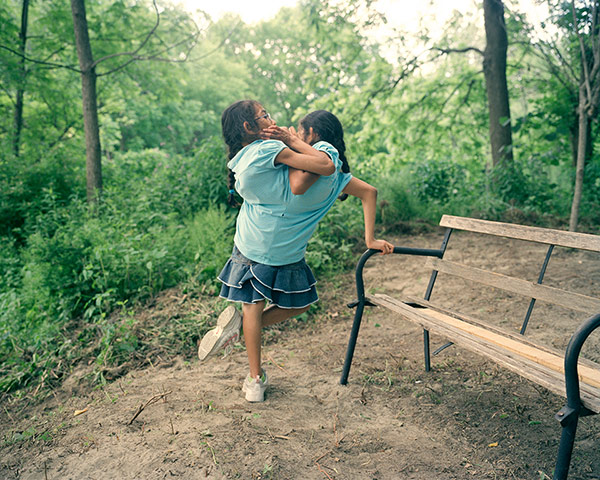 Conjoined twins: Conjoined twins: Carmen and Lupita