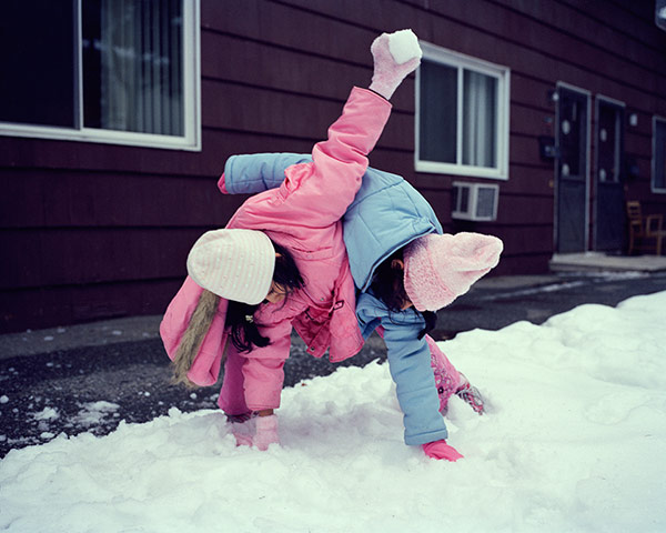 Conjoined twins: Conjoined twins: Carmen and Lupita