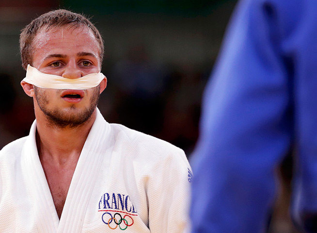 Olympic pain: France's Ugo Legrand with his nose taped after being injured