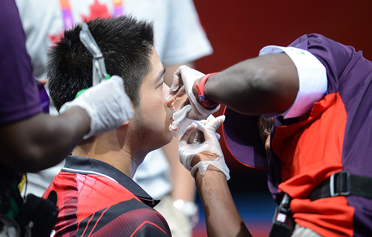 Olympic pain: Andre Ho of Canda gets medical treatment after an nose injury