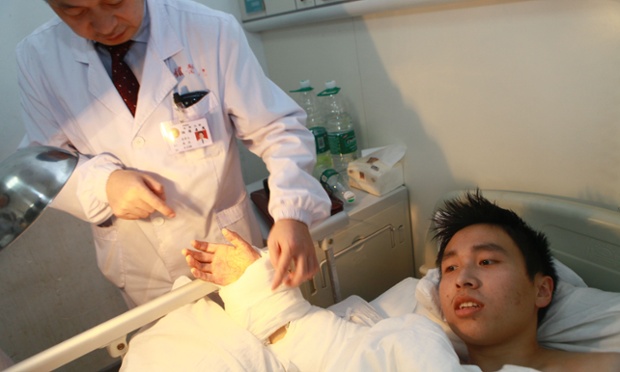 Nearly a month after his hand was severed, Xiao had recovered enough to undergo re-attachment surgery. According to doctors he will need to undergo several other surgeries but they are hopeful that he will regain full function of his hand.