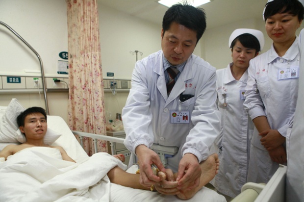 Doctors have successfully re-attached a man's severed hand after it was attached to his ankle for a month.