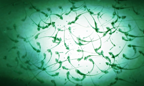 Sperm, microscopic