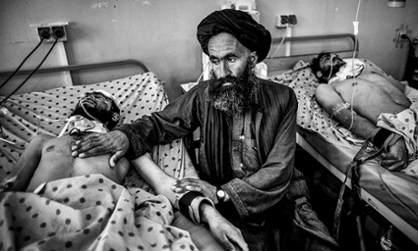 Injured men being treated in Mirvays Hospital after in a Taliban attack in Kandahar