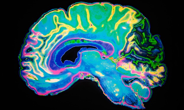 Warning over experimental brain boost