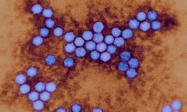 Appearance of polio-like disease in California's children perplexes ...