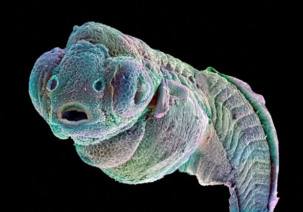 False-coloured scanning electron micrograph of a zebrafish embryo.