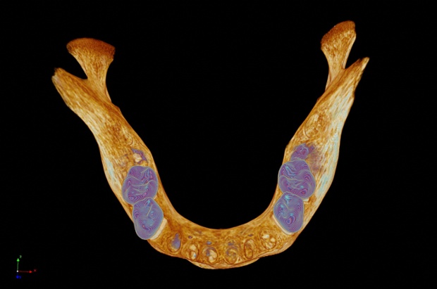 Bird's eye view of a model of a medieval human mandible (lower jawbone), captured using a a micro CT scanner.