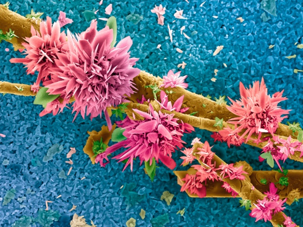 False-coloured SEM of an agricultural sludge sample after burning in an oxygen atmosphere.