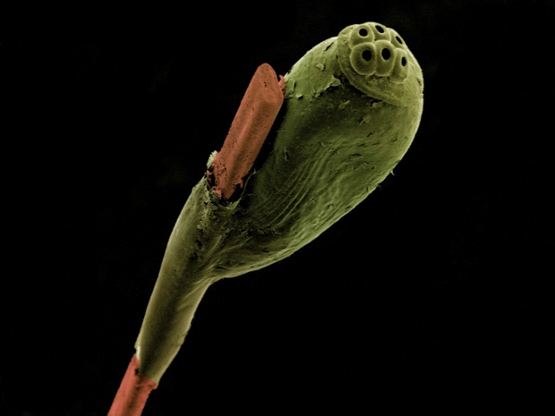 False-coloured scanning electron micrograph of a head louse egg (green) attached to a strand of human hair (brown).