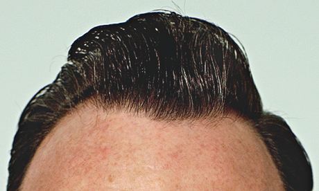 What happens when a mere mortal tries to copy a footballer's hair?