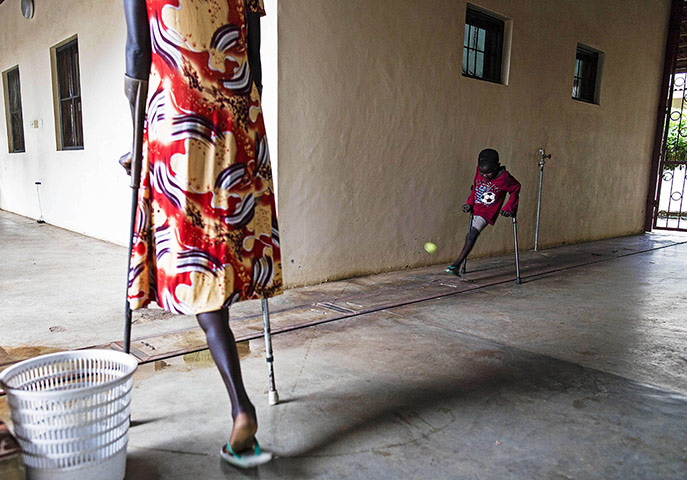 20 Photos: Seven-year-old amputee, Deng (R) plays