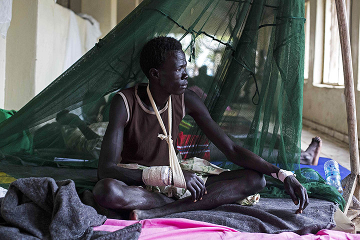 20 Photos: A man sits in a hospital in Bor, South Sudan, after tribal clashes