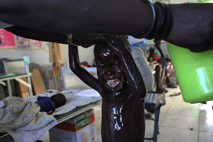 20 photos: A South Sudanese child displaced by the fighting in Malakal is washed