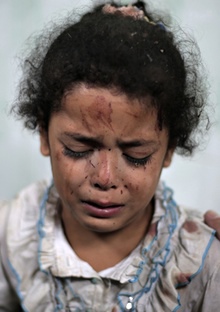 A Palestinian girl 220 cries while receiving treatment for her injuries caused by an Israeli strike.