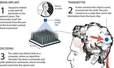 neurobridge graphic