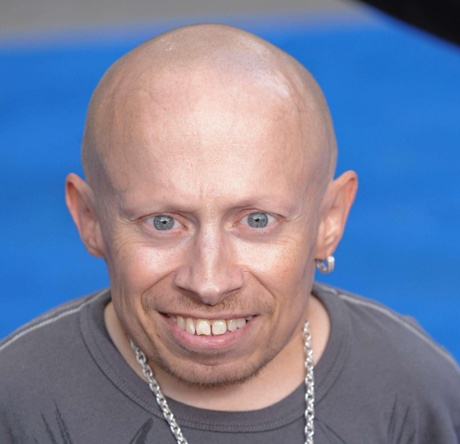 Verne Troyer