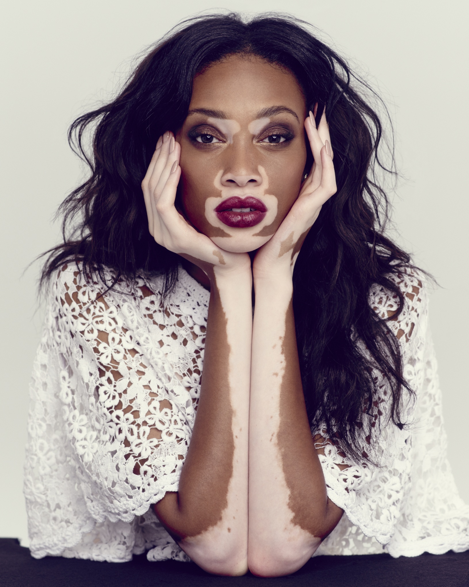 chantelle-winnie-a-model-in-demand-in-pictures-global-the-guardian