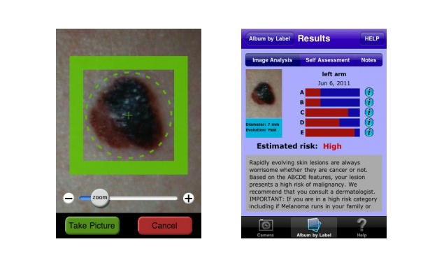 FTC fines apps firms for claiming their technology could detect melanoma