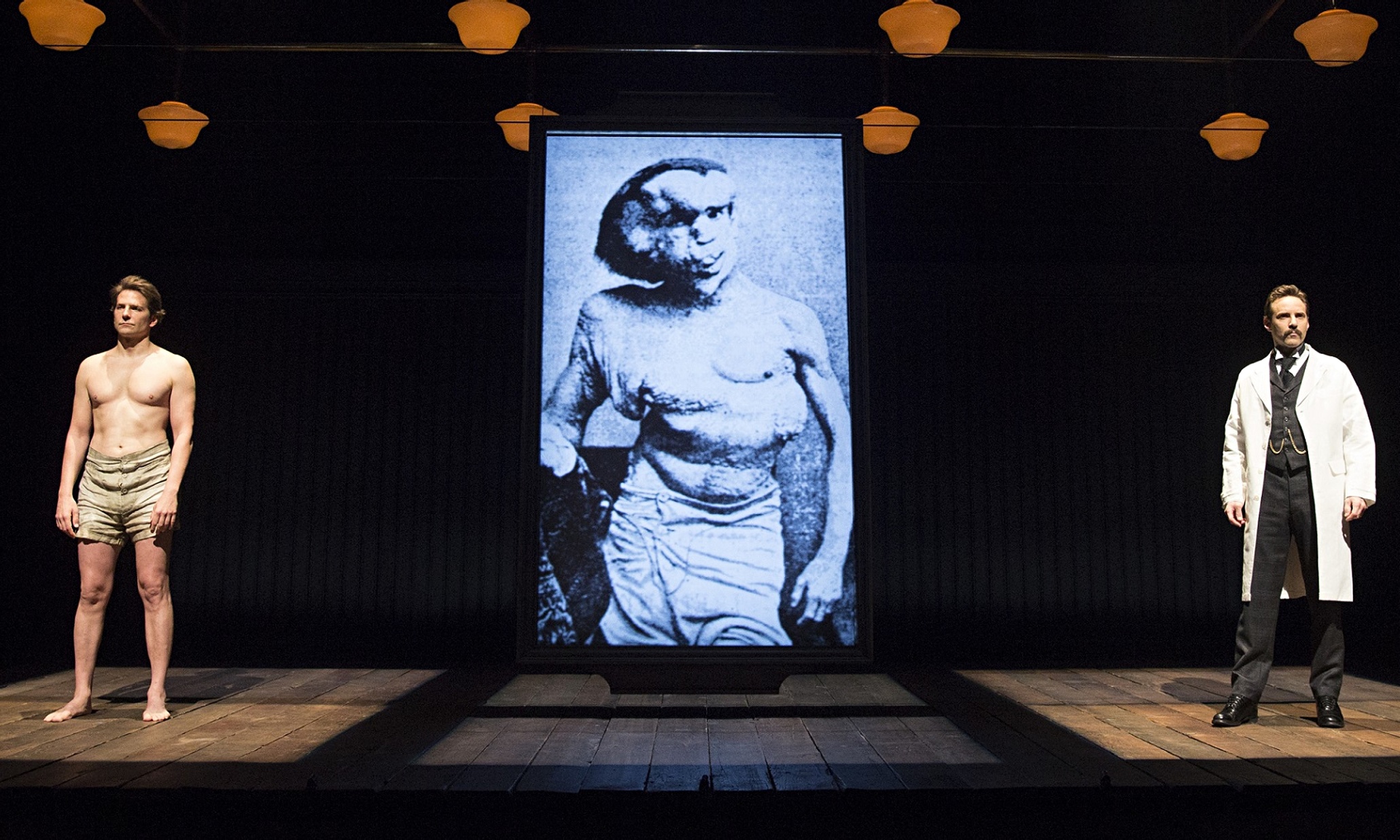 The Elephant Man review – makes you long to see Bradley Cooper in classic roles - The Guardian