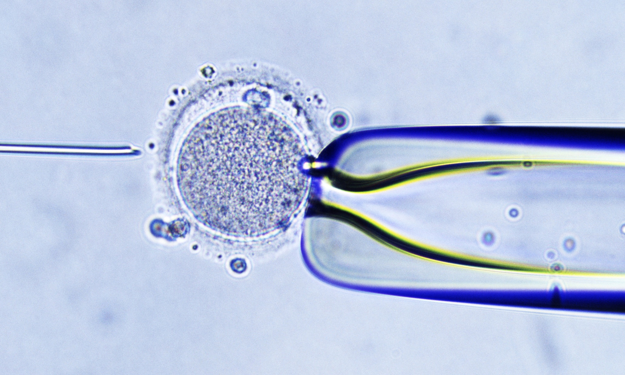 Court reserves judgment in dispute over dead daughter's frozen eggs