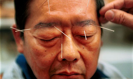 A man undergoing acupuncture