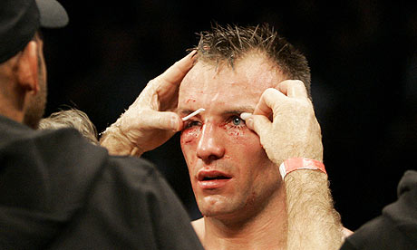 Mikkel-Kessler-001.jpg