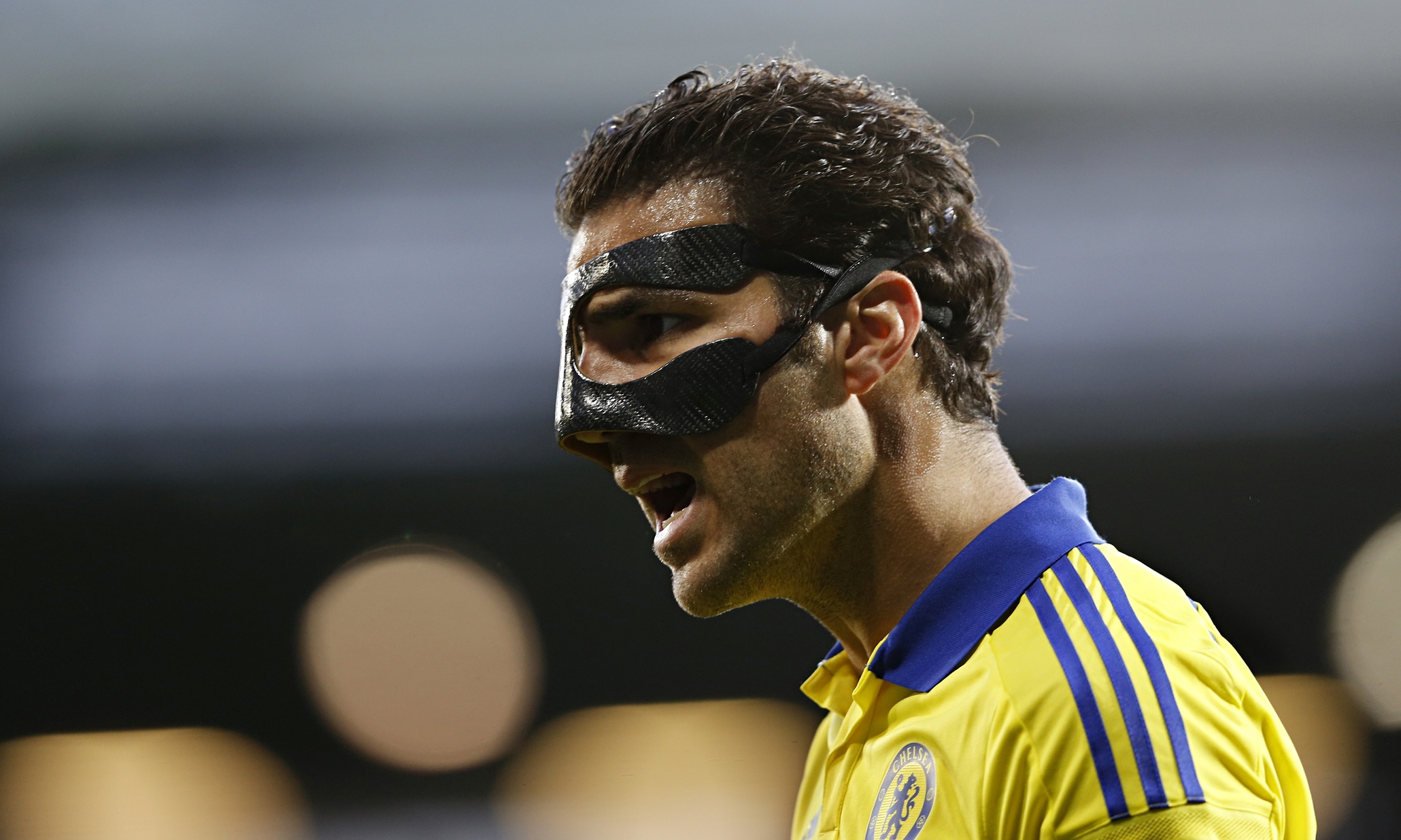 Chelsea’s Cesc Fàbregas undergoes successful surgery on broken nose